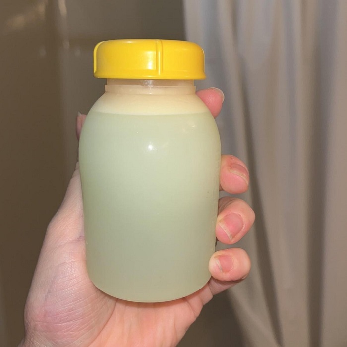 green breast milk